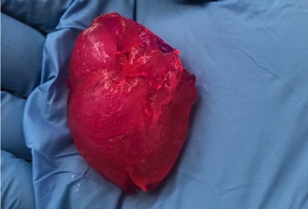Чикагская биокомпания сумела напечатать человеческое мини-сердце