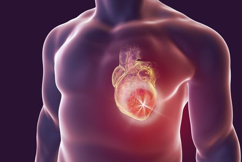 Сердце не любит понедельники и смог, выяснили польские кардиологи